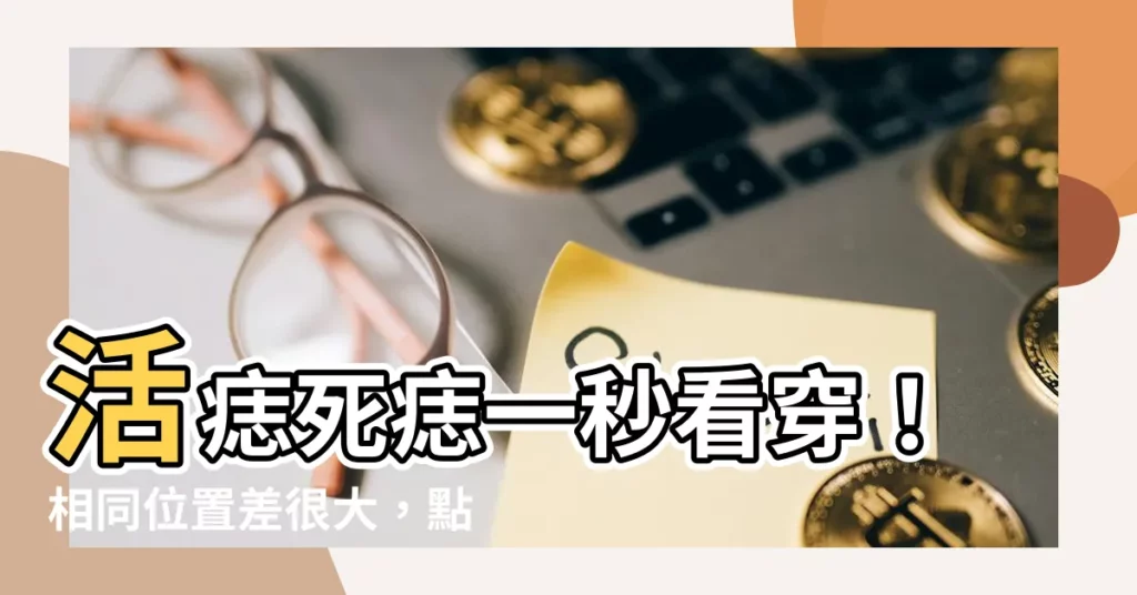 【活痣和死痣】活痣死痣一秒看穿！相同位置差很大，點痣前先搞懂！