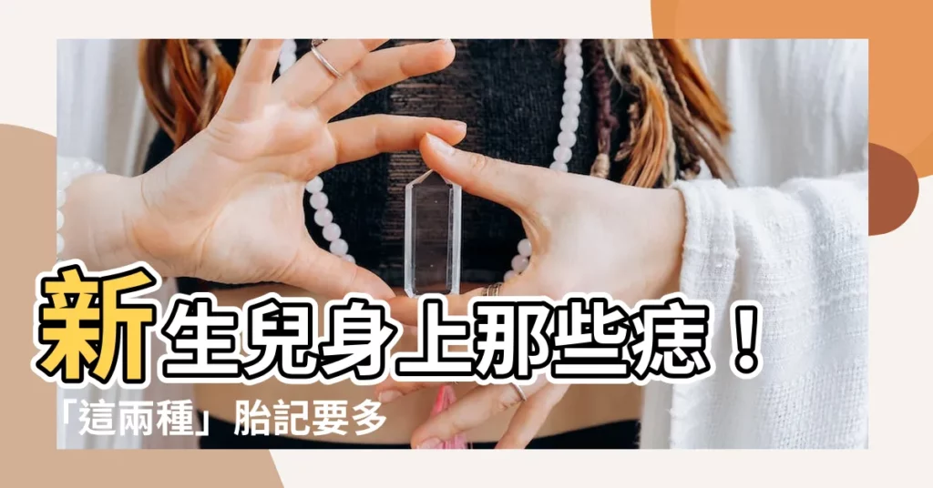 【新生兒痣】新生兒身上那些痣！「這兩種」胎記要多加留意了！